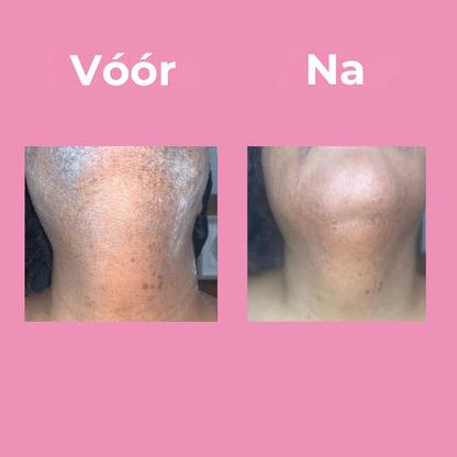 Professionele Ontharingscrème Unisex