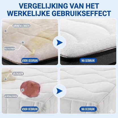 Matrasvlekken Verwijderaar Spray-300ML