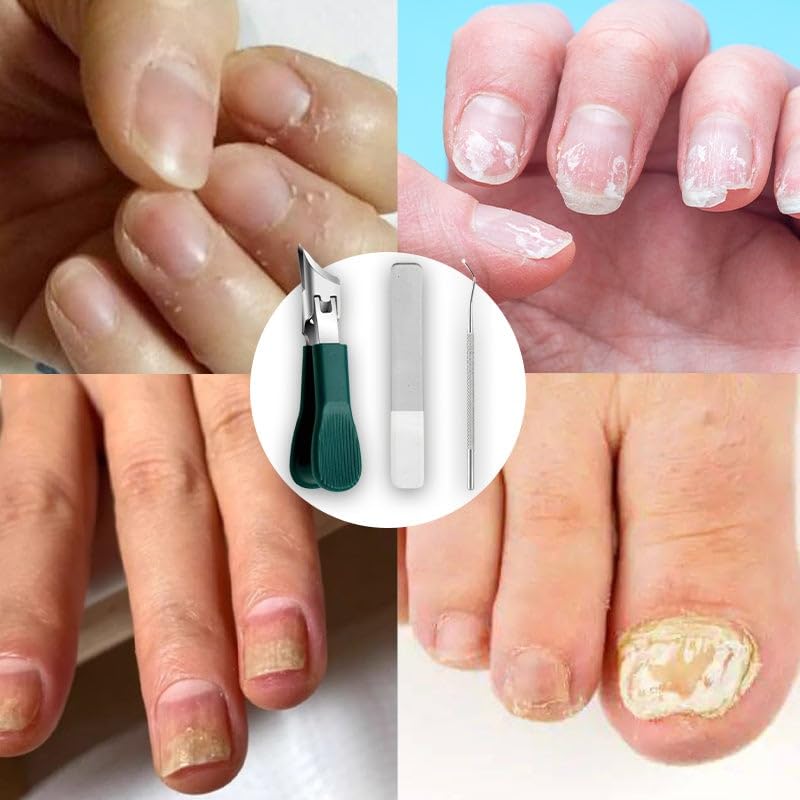 Professionele Nageltang voor Ingegroeide en Dikke Nagels – Adelaarssnavel Ontwerp